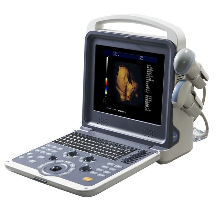 Urology Ultrasound Scanner