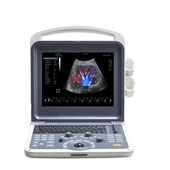 Sonda d'ultrasò Transductor d'ultrasò