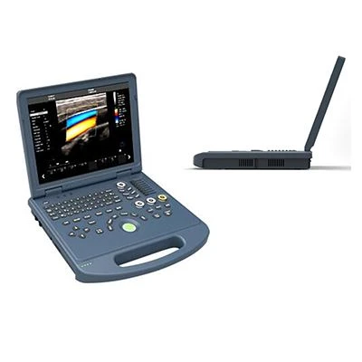Màquina d'ecografia Doppler color portàtil