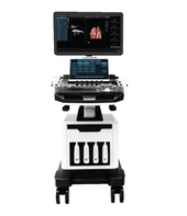 Trolley 5D Ultra Doppler Color