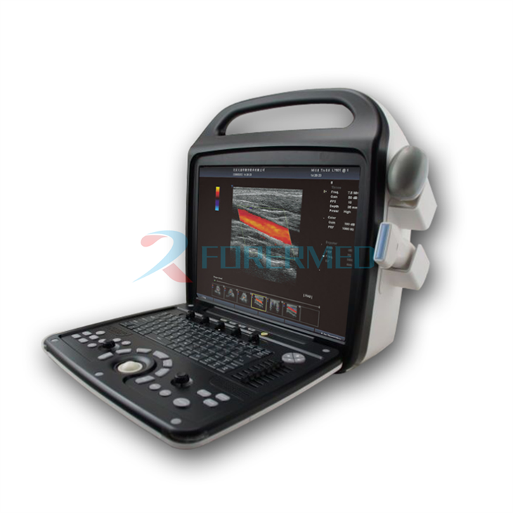 Ecografia Doppler color 4d